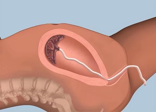 伤口|分娩结束后,男医生又把手伸进产妇肚子里,别急骂医生是为了你好