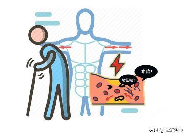 血管内膜|心血管科医生:这4种家常菜,或是血栓的“帮凶”,劝你管住嘴