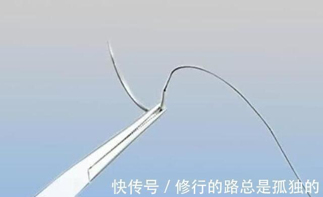 孕妇|为啥现在的剖腹产都不用“拆线”不“拆线”的利弊,孕妇要清楚