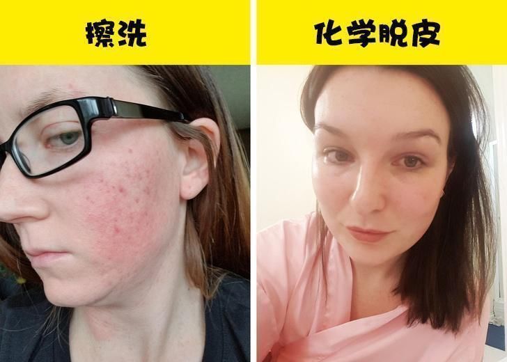 滋补品|大多数女性在进行面部护理时所犯下的10种错误