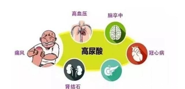 肾衰竭|尿酸高的人注意:若你的身体有这4种表现,可能是肾衰竭找来了