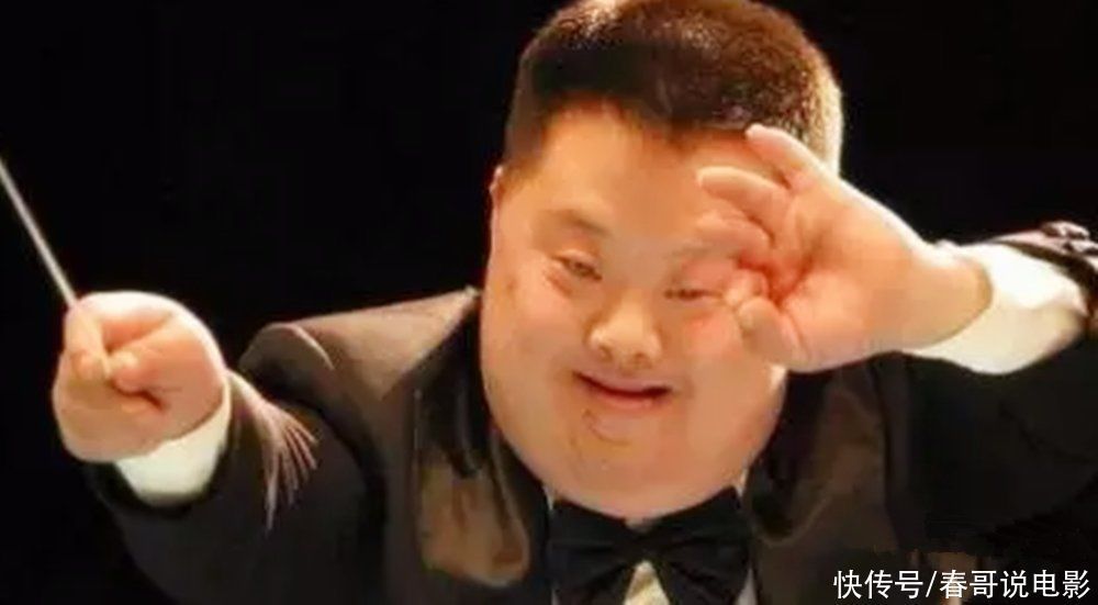 产检|孕妈不想生下“傻孩子”,孕期几项产检要按时做,忽视不得