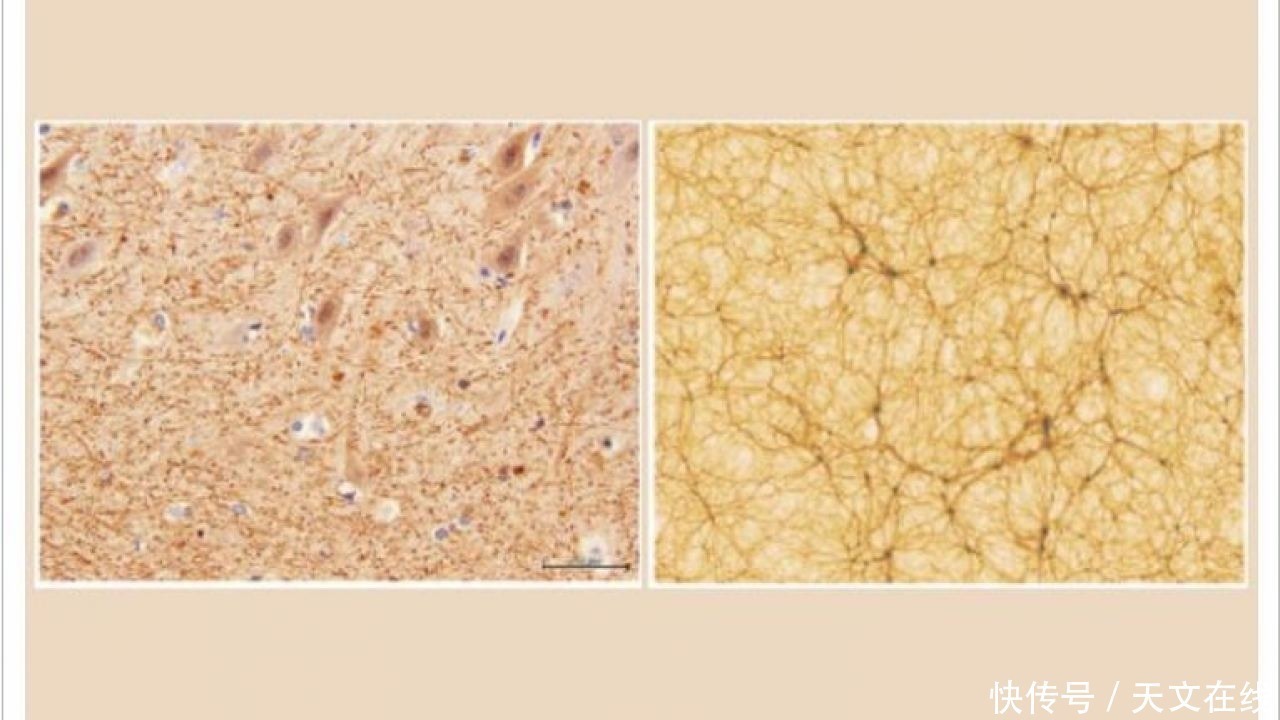 脑洞大开,宇宙与大脑竟然有很多相似之处