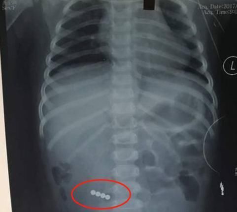 夺命玩具|这5种“夺命玩具”,家长别买给孩子,快看看孩子的书包里有没有