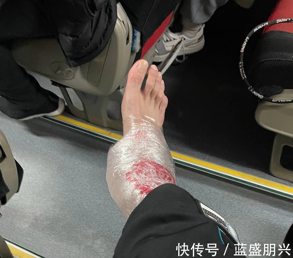 辽粤大战|韩德君鼻子骨折!一人崴脚!辽宁最新伤病名单出炉,杨鸣损失惨重!