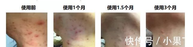 娥佩兰|3款会踩雷"黑名单"护肤品,口碑好但巨难用,风再大也不要买