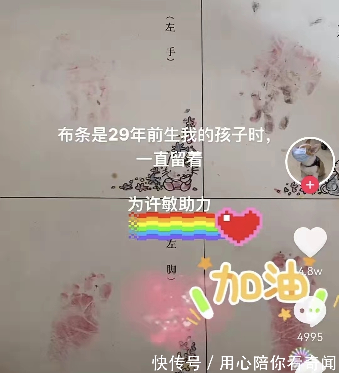 母亲|推翻医院杜新枝谎言,91年淮医产妇拿出脚印手环,全留着作纪念呢