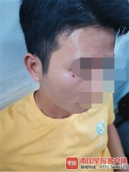 地板|验房师验房时遭人打伤报警，涉事者被传唤后称自己也需验伤