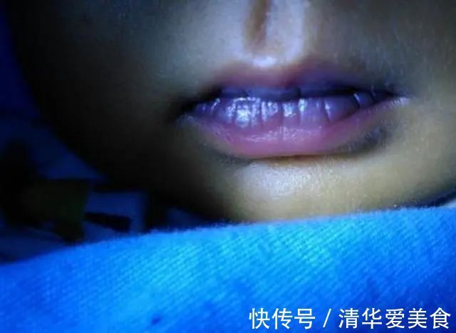 血管|血液粘稠的人，身体2处会发出信号，若没有，血管还比较畅通