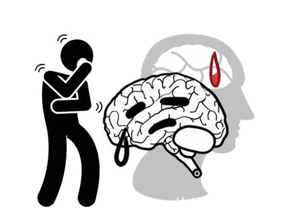 现象|身体出现4种变化,或是糖尿病肾病来了,及时检查,别拖成尿毒症