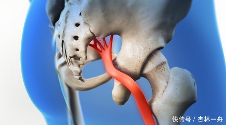 腰椎管狭窄做哪些检查治疗,避免严重产生马尾综合征,怎么恢复?