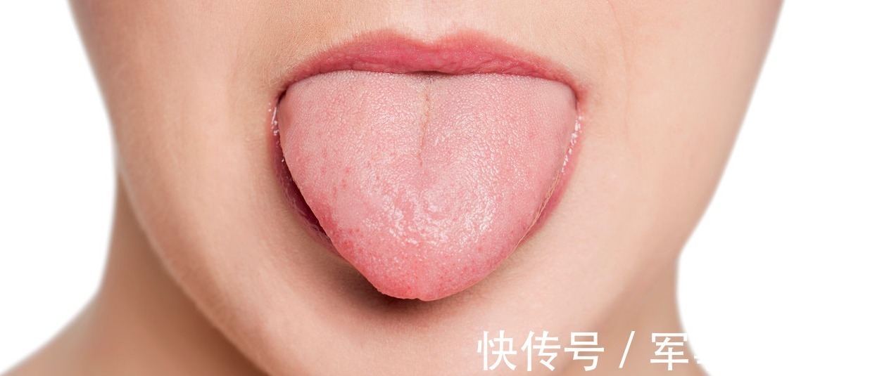 健脾丸|舌头肥大，周围还有齿痕，这到底是怎么回事？中医中该如何治疗？