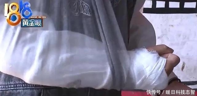 陈赫火锅店天花板砸伤顾客,店家只愿赔4万,伤者无奈公开维权!