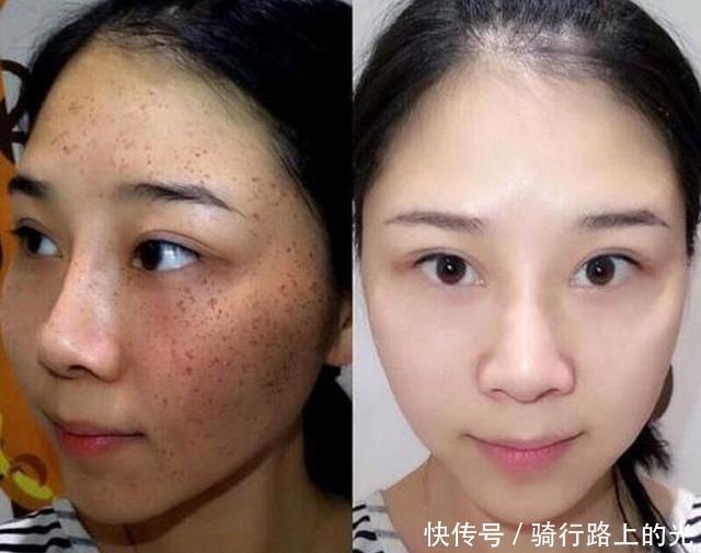 断货王|那些“断货王护肤品”太坑了,粉水、黄油均上榜,用完长痘还过敏