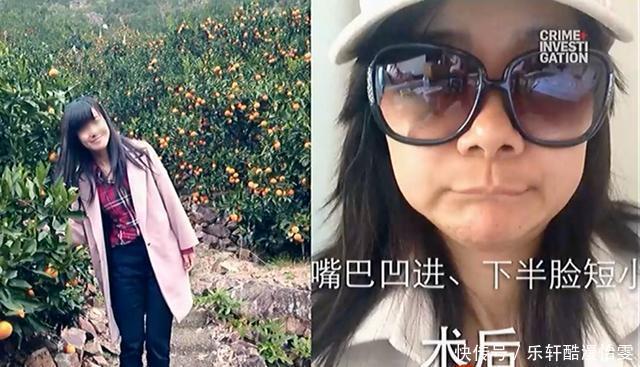 女孩|被整容毁掉的女孩“我的整形医生,只给鸡腿做过手术”