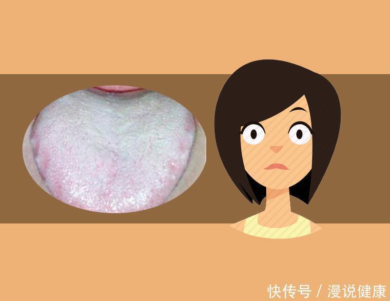 舌苔|大病来袭,舌头告知?舌头出现这3种现象,劝你务必最好做下检查