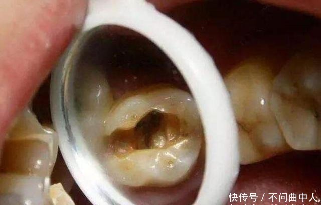 孩子们|家里这3样东西,比糖还容易让孩子长“黑牙”,家长别让孩子碰