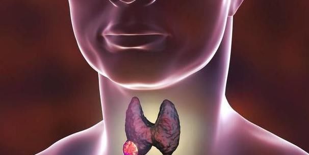 乳腺癌|不同的肿瘤生存时间不同,两种人患癌还能活很长时间,你身边有吗