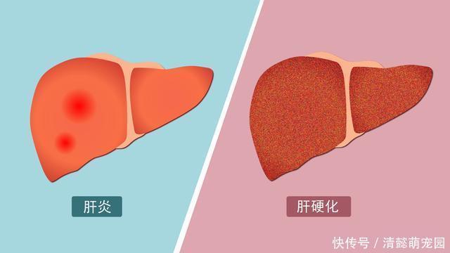 “三甜”伤肝，尽量少吃，“二苦”养肝，最好多吃，务必牢记在心