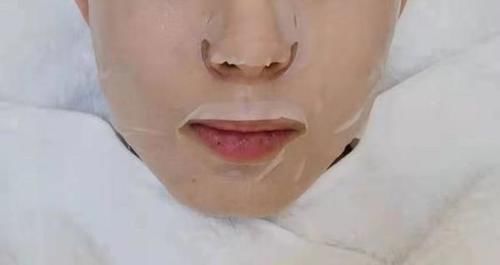 容貌焦虑!90 后现在流行做医美,图什么?