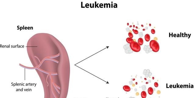 经络|中医谈疼、痛、痒、酸、胀、麻、疲、乏、饥、饿、劳、累、聪