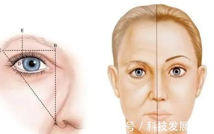 筋膜 关于拉皮手术的16个真相,很多人都不知道真假!