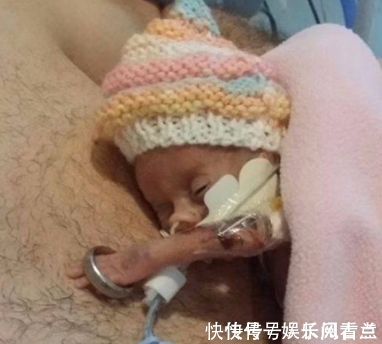 婚戒|生命斗士!出生体重不到1斤,手能穿过戒指,英迷你婴儿长大了!
