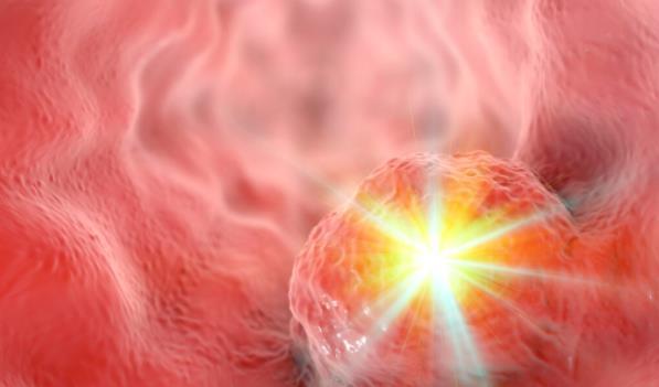 因素|最常见的致癌因素，就藏在中国人的餐桌上！这2种食物务必少吃