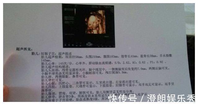 股骨长|孕检时,若怀的是男宝宝,多数会有这3种孕检结果,你都符合吗?