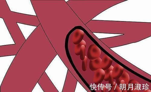 睡眠质量|失眠的人,长期吃安眠药,对身体有哪些影响?失眠到底该怎么办?