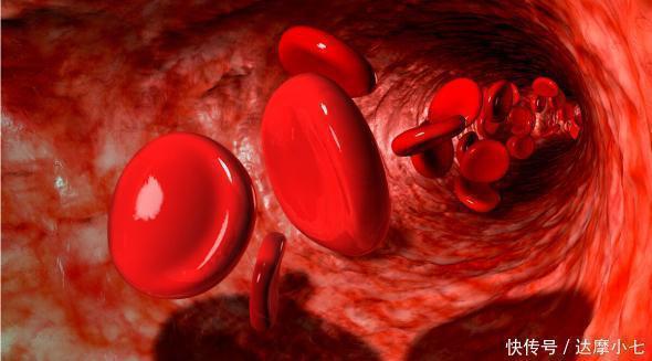 营养物质|医生30年经验总结:4个方法轻松对付高血脂,别只知道傻傻吃药