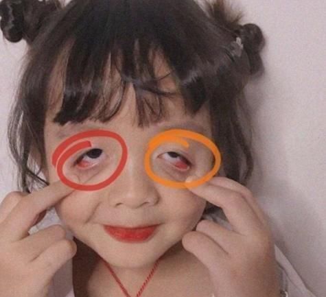 月经|女孩子几岁“来月经”算合格医生“这岁数”才正常，请别忽视