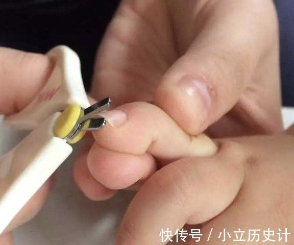 脆弱|从宝宝指甲能看出健康程度?这些宝宝的指甲问题该如何处理?
