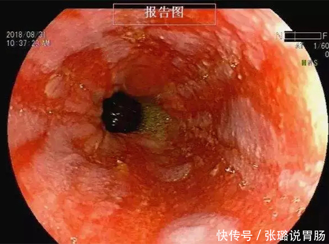 健康饮食|《黄帝内经》:千古流传的健康饮食秘诀!