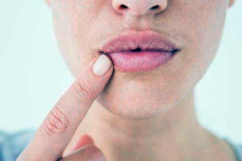 女性|女人有妇科病,嘴巴常会有几种表现暗示你,希望你一个都没有