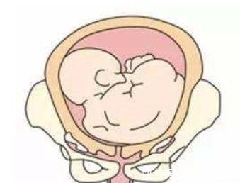 发育不良|怀孕时,孕妇的这三项“指数”不达标,是胎儿发育不良的信号!