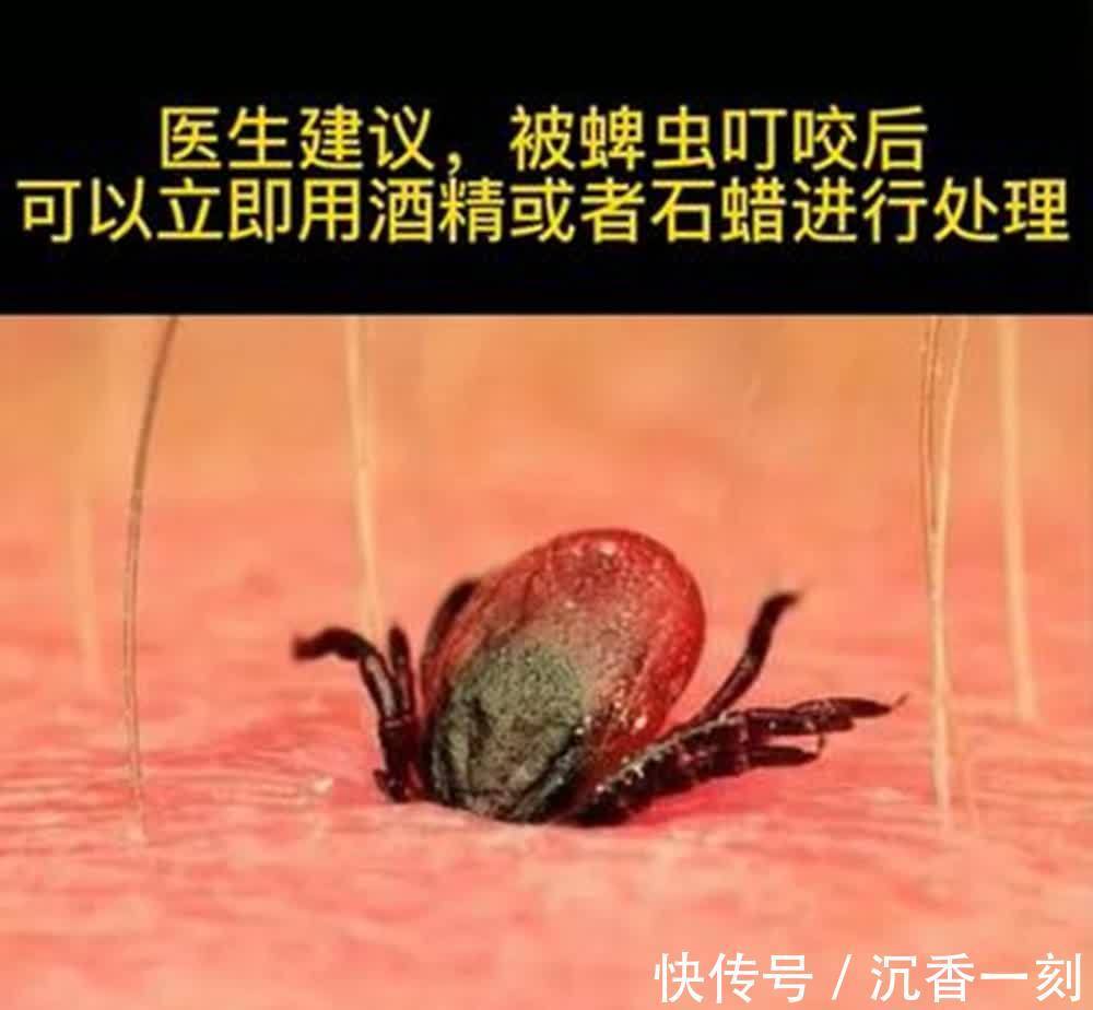 蜂刺|江西出生4天婴儿被蜱虫咬伤,夏季驱虫“三及时”,不让娃白遭罪