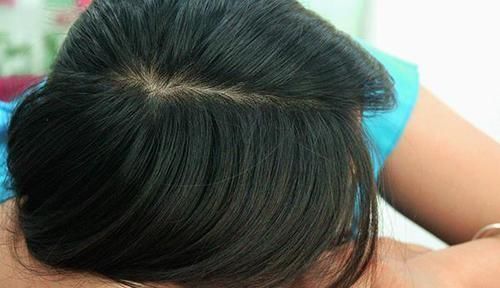 身体中|脾虚,身体就“毁”一半!学会三招,健脾养胃,现在知道还不晚