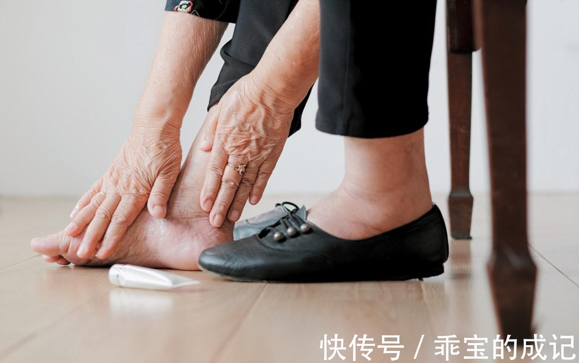 腹痛|胰腺癌被称为“癌王”？有6大类高危人群，有哪些典型的征兆？