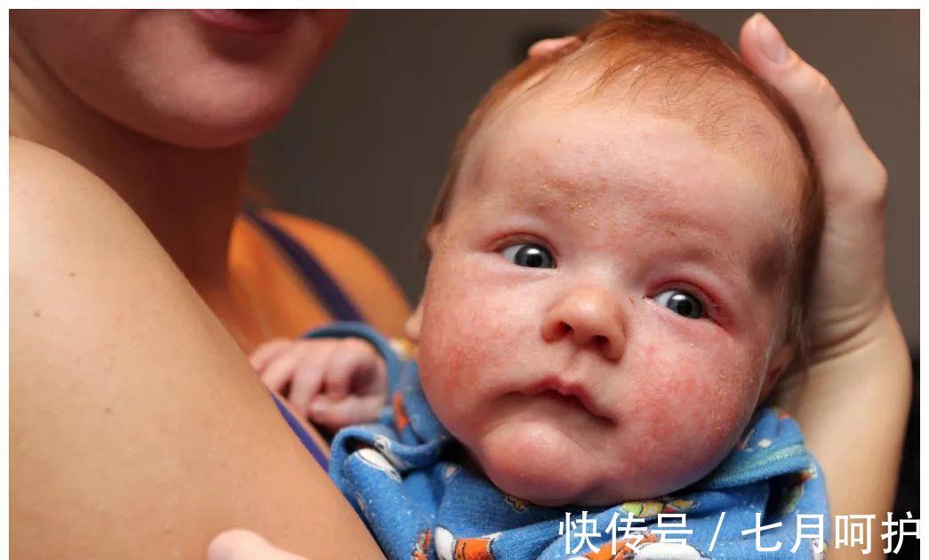 肠绞痛|超实用!史上最全宝宝护理知识合集!值得收藏!