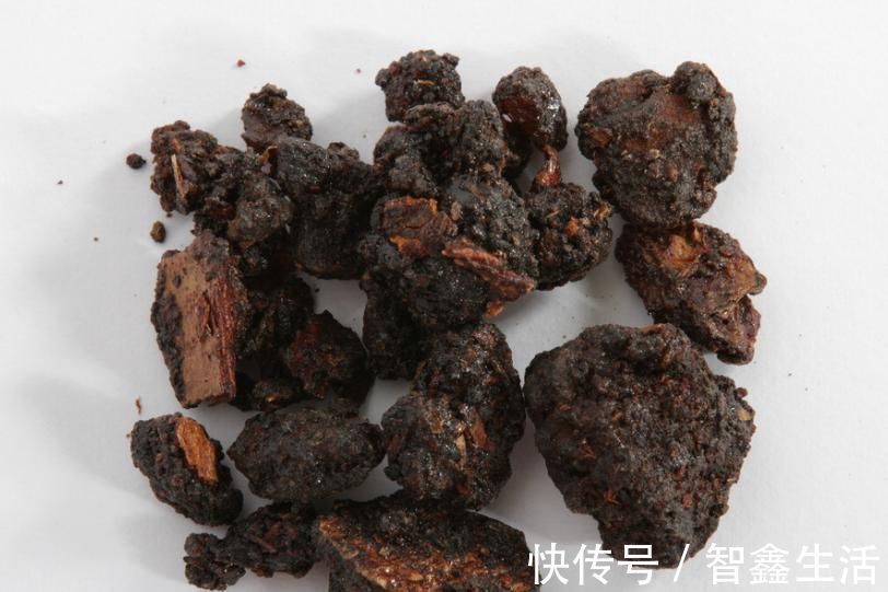 腰腿痛|肩痛、背痛、心痛、腹痛、腰痛、腿痛，张锡纯一个方子，统统不见