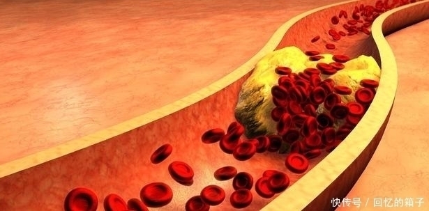 血脂|甘油三酯大于17很简单,1种粗粮煮水喝,血脂轻松降