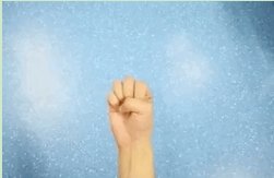 桡骨茎突狭窄性腱鞘炎|“妈妈手”是怎么形成的？它可不是妈妈的专利