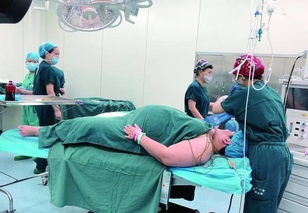 产房|超重产妇产房四道难关后,生下82斤巨婴,手术刀口全是油