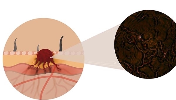 被世卫组织列为第一类致癌物,与烟草同级别,你知道哪些?