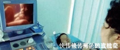 分化|怀孕第几周最危险 妇产医生 畸形和胎停容易发生在这一周!