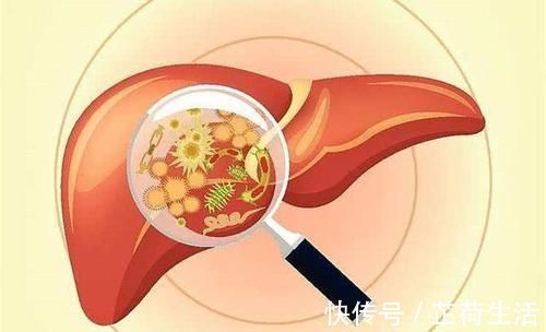 修复|肝硬化患者常吃3物，清肝毒，修复肝细胞，肝脏慢慢养好