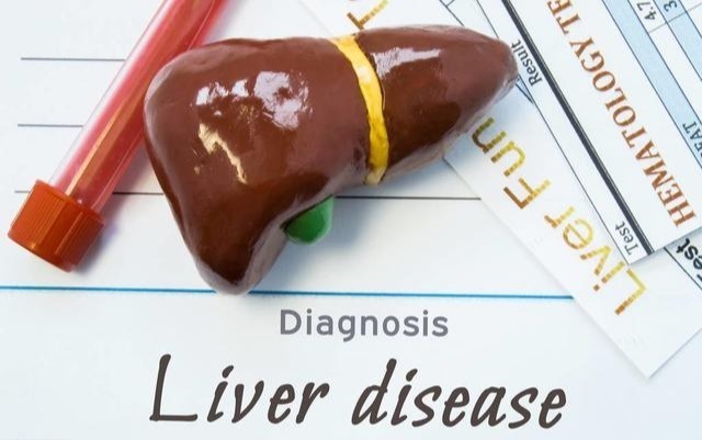 营养不良|肝硬化的“5大症状”,希望你一个都没有,“8个”调理肝硬化方法