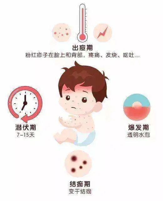  防控|水痘来了，您做好防控了吗？