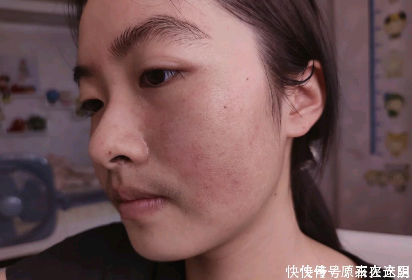 羊脂酸|“长期化妆”会使皮肤变差,到底是真的还是假的看完你就明白了